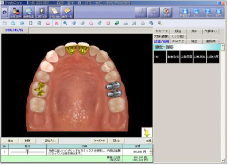 歯科院内データ統合管理ソフト